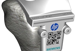 Siemens And Hp Color 3 D Printed Surgincal Cutting Guide 2